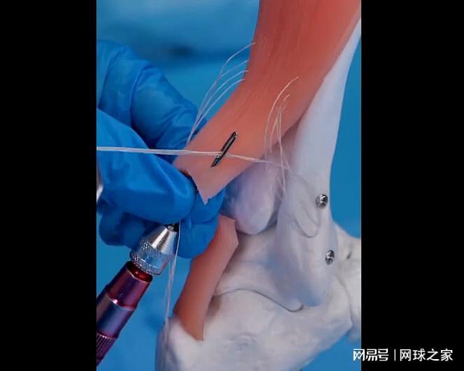 net, 我们再回到, img